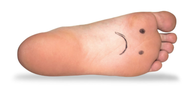 Hygiène des pieds diabétiques